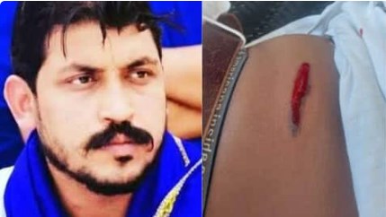 भीम आर्मी के प्रमुख चंद्रशेखर आजाद पर देवबंद में जानलेवा हमला, कमर को जख्मी करते निकली गोली